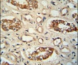 PPM1L Antibody in Immunohistochemistry (IHC)
