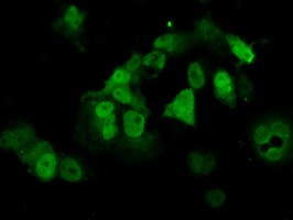 PPME1 Antibody in Immunocytochemistry (ICC/IF)