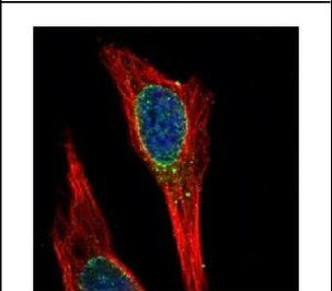 PP1 alpha Antibody in Immunocytochemistry (ICC/IF)