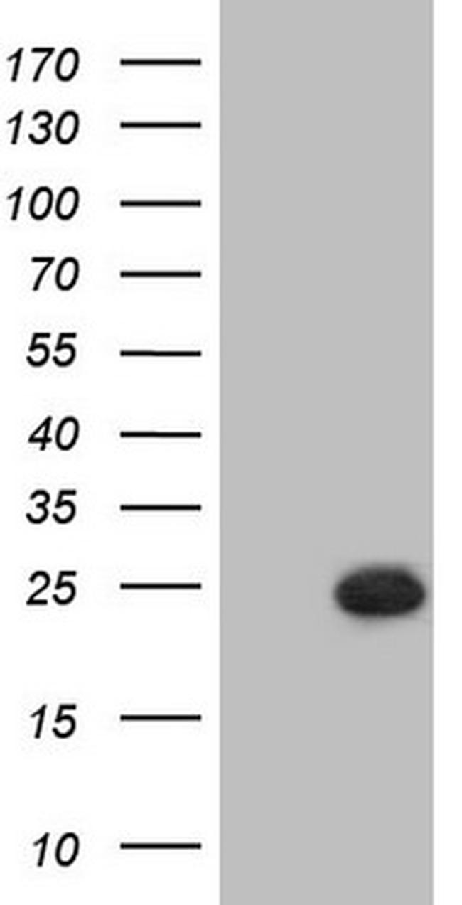 PPP1R17 Antibody in Western Blot (WB)