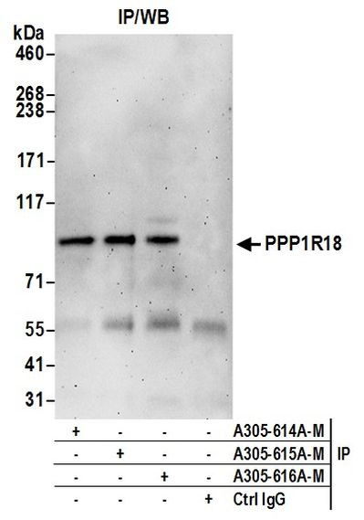 PPP1R18 Antibody in Immunoprecipitation (IP)