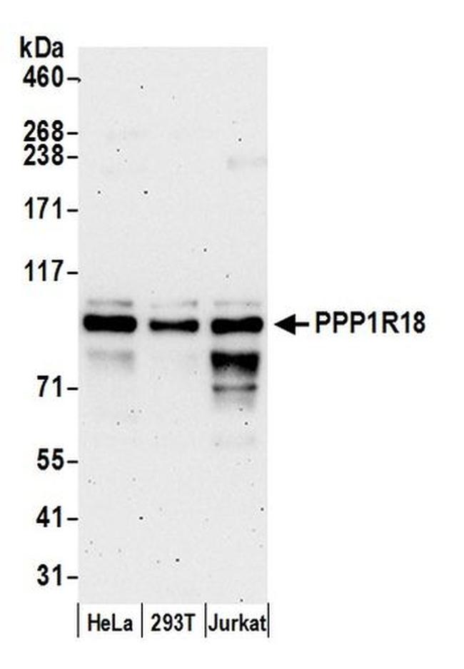 PPP1R18 Antibody in Western Blot (WB)
