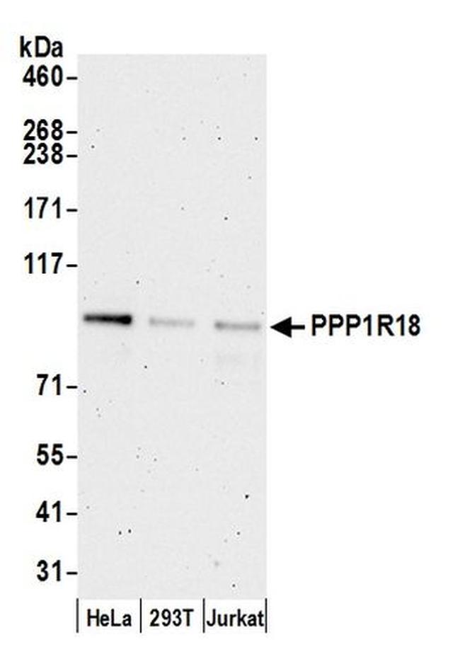 PPP1R18 Antibody in Western Blot (WB)