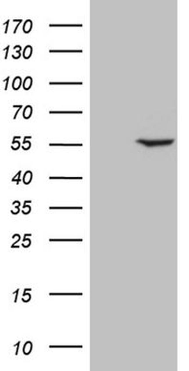 PPP1R36 Antibody in Western Blot (WB)