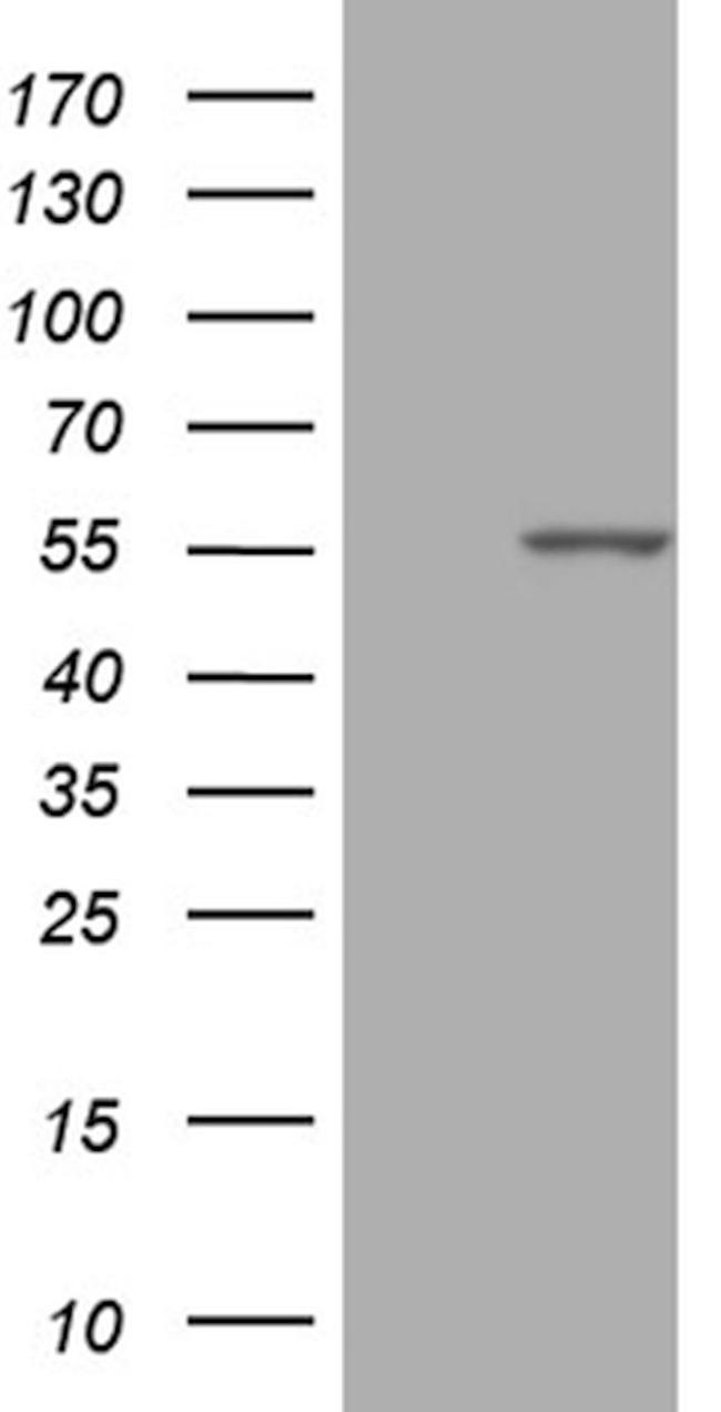 PPP1R36 Antibody in Western Blot (WB)