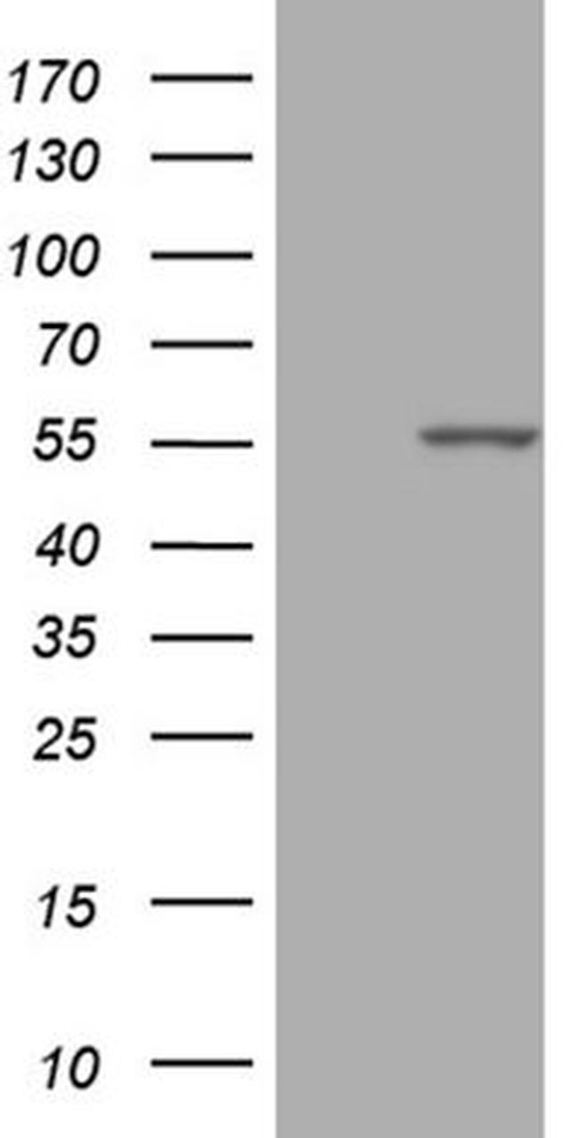 PPP1R36 Antibody in Western Blot (WB)