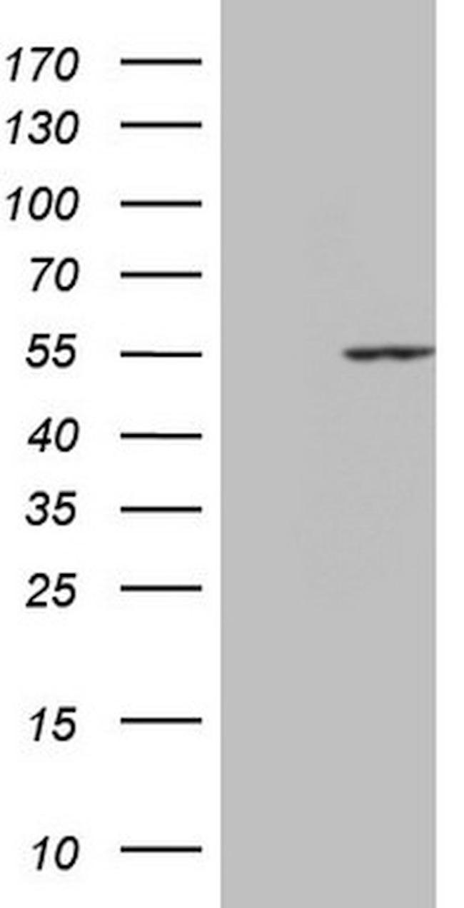 PPP1R36 Antibody in Western Blot (WB)