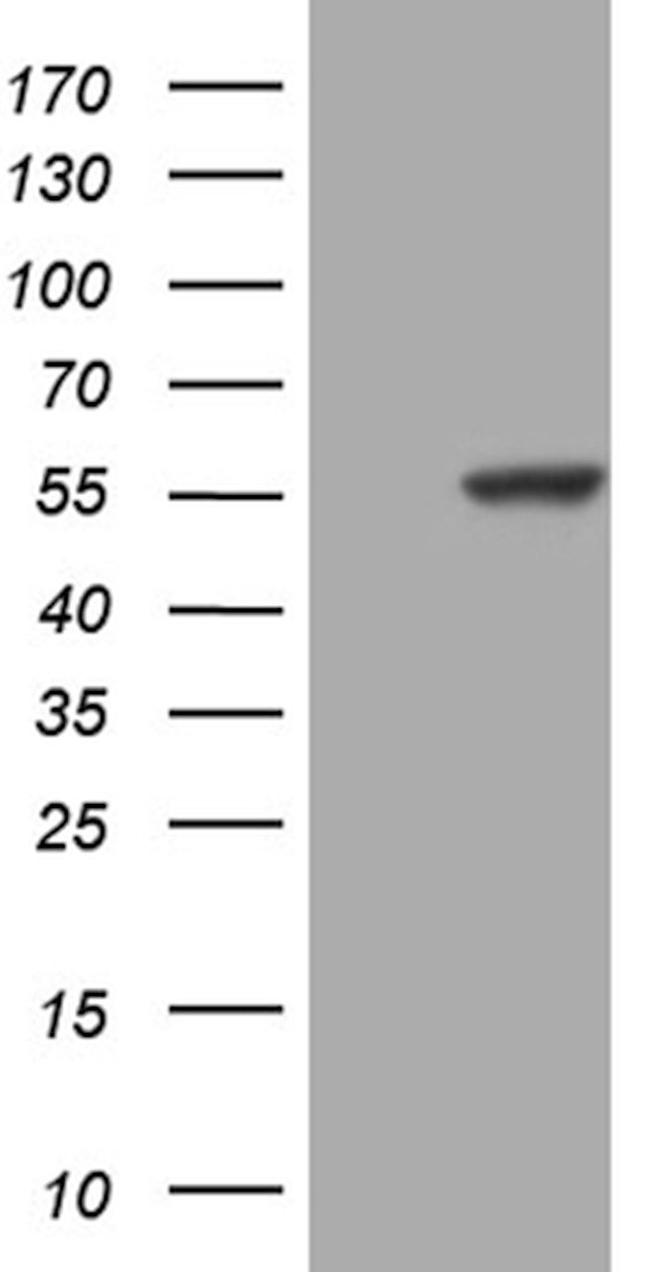 PPP1R36 Antibody in Western Blot (WB)