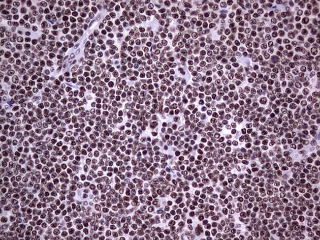 PPP1R8 Antibody in Immunohistochemistry (Paraffin) (IHC (P))