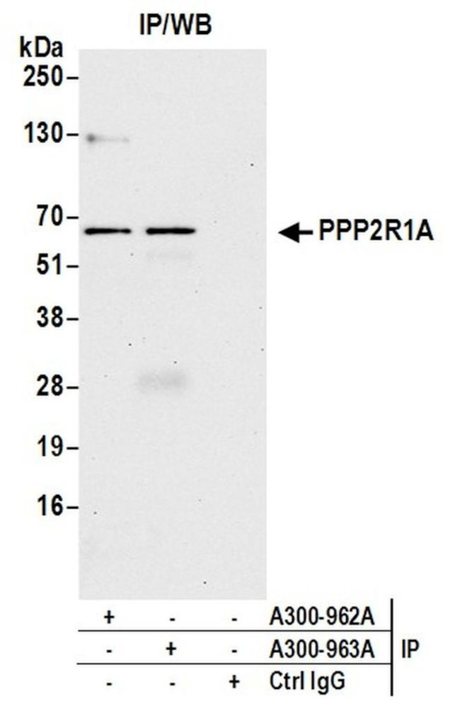 PPP2R1A Polyclonal Antibody (A300-962A)