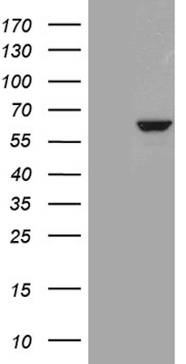 PPP2R1B Antibody in Western Blot (WB)