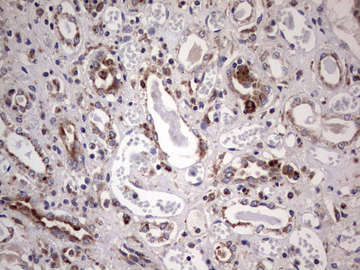 PPP2R5D Antibody in Immunohistochemistry (Paraffin) (IHC (P))