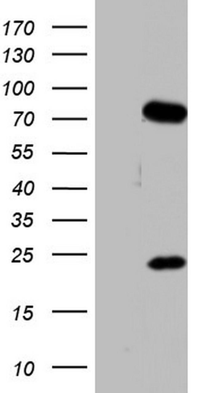 PPP2R5D Antibody in Western Blot (WB)