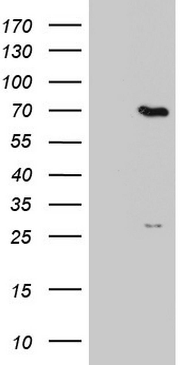 PPP2R5D Antibody in Western Blot (WB)