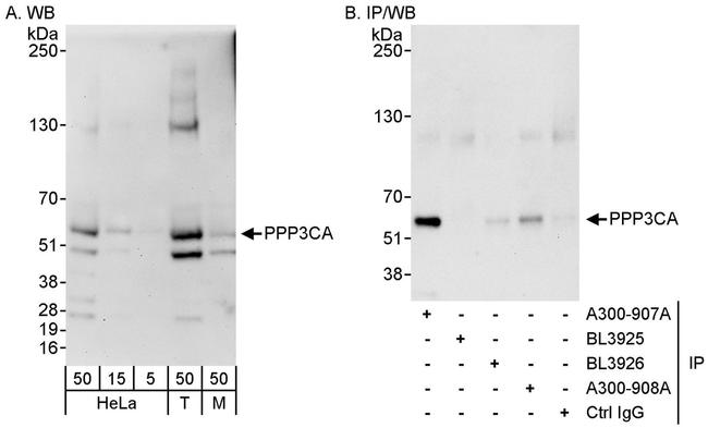 PPP3CA Polyclonal Antibody (A300-907A)