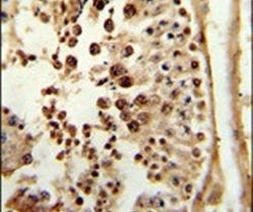 PPP3R2 Antibody in Immunohistochemistry (IHC)