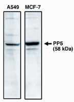PP5 Antibody in Western Blot (WB)