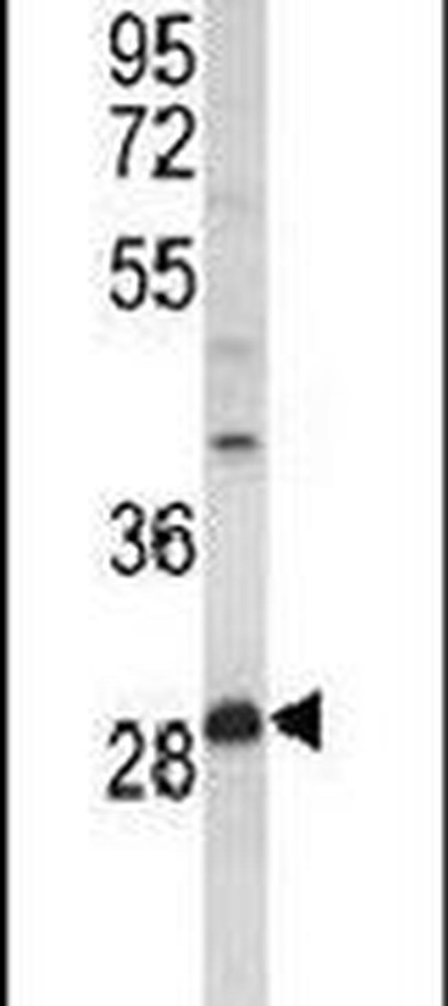 PPT1 Antibody in Western Blot (WB)