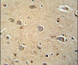 PQLC1 Antibody in Immunohistochemistry (IHC)