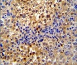 PR38A Antibody in Immunohistochemistry (IHC)