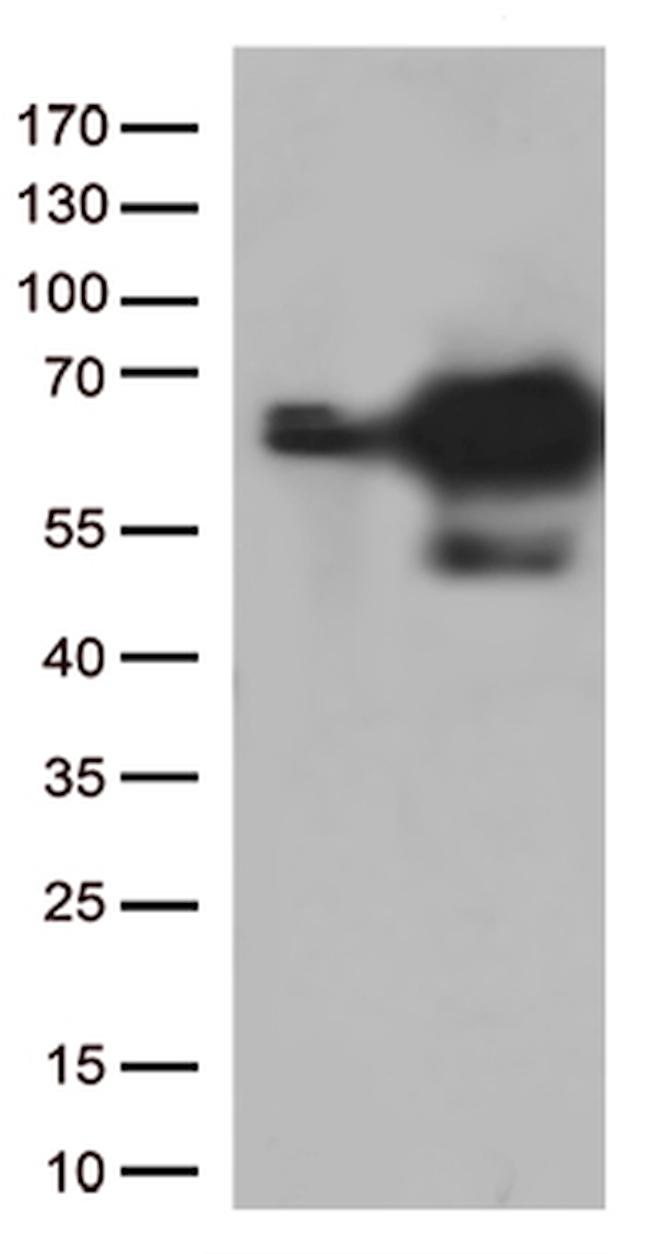 PRCC Antibody in Western Blot (WB)