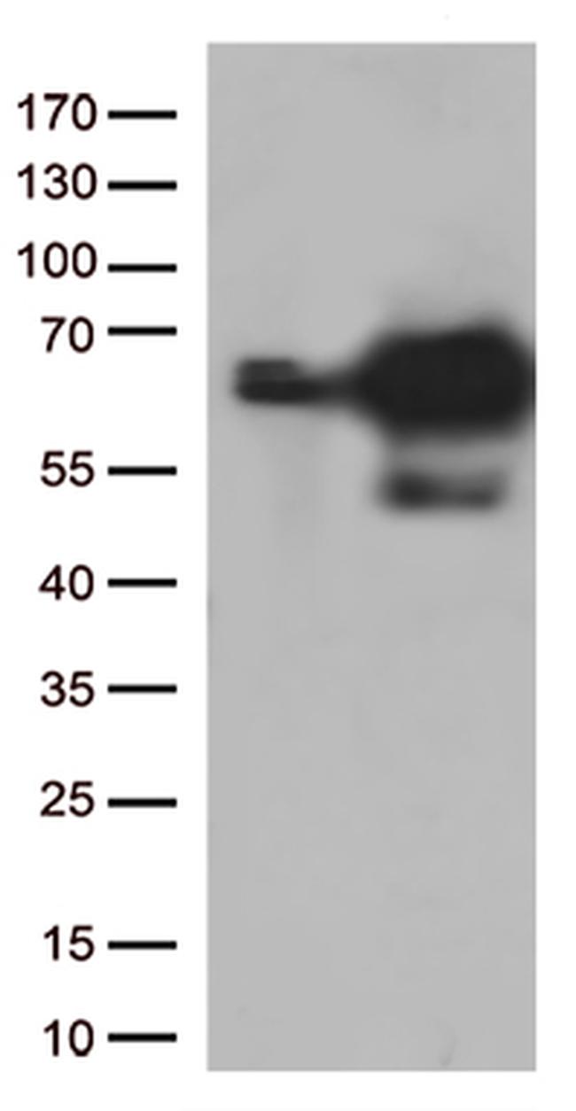 PRCC Antibody in Western Blot (WB)