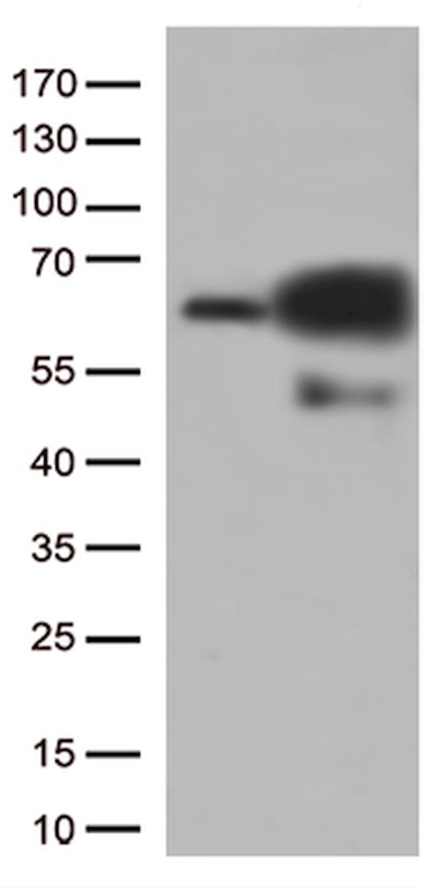 PRCC Antibody in Western Blot (WB)
