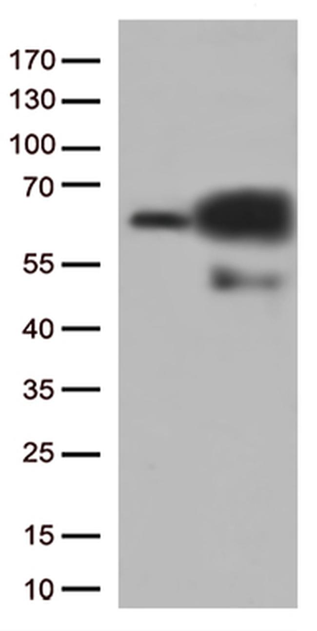 PRCC Antibody in Western Blot (WB)