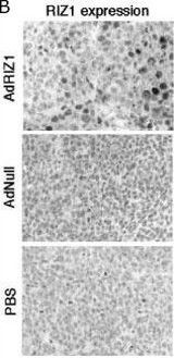 PRDM2 Antibody in Immunohistochemistry (IHC)