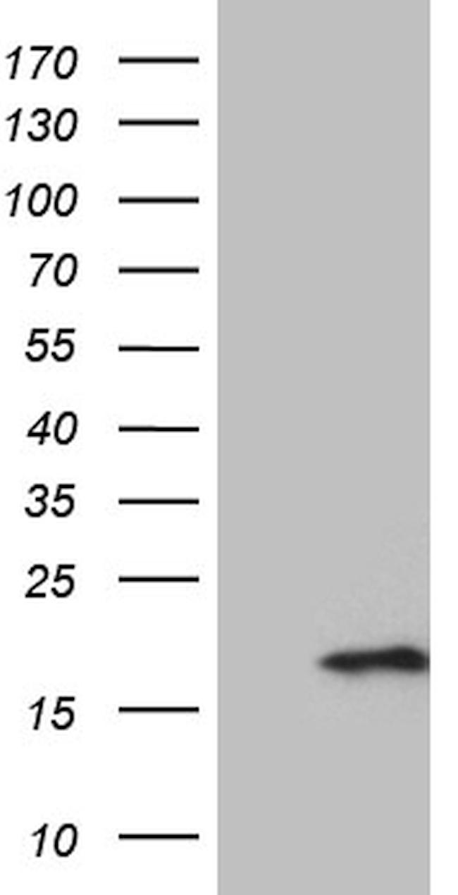 PRELID2 Antibody in Western Blot (WB)