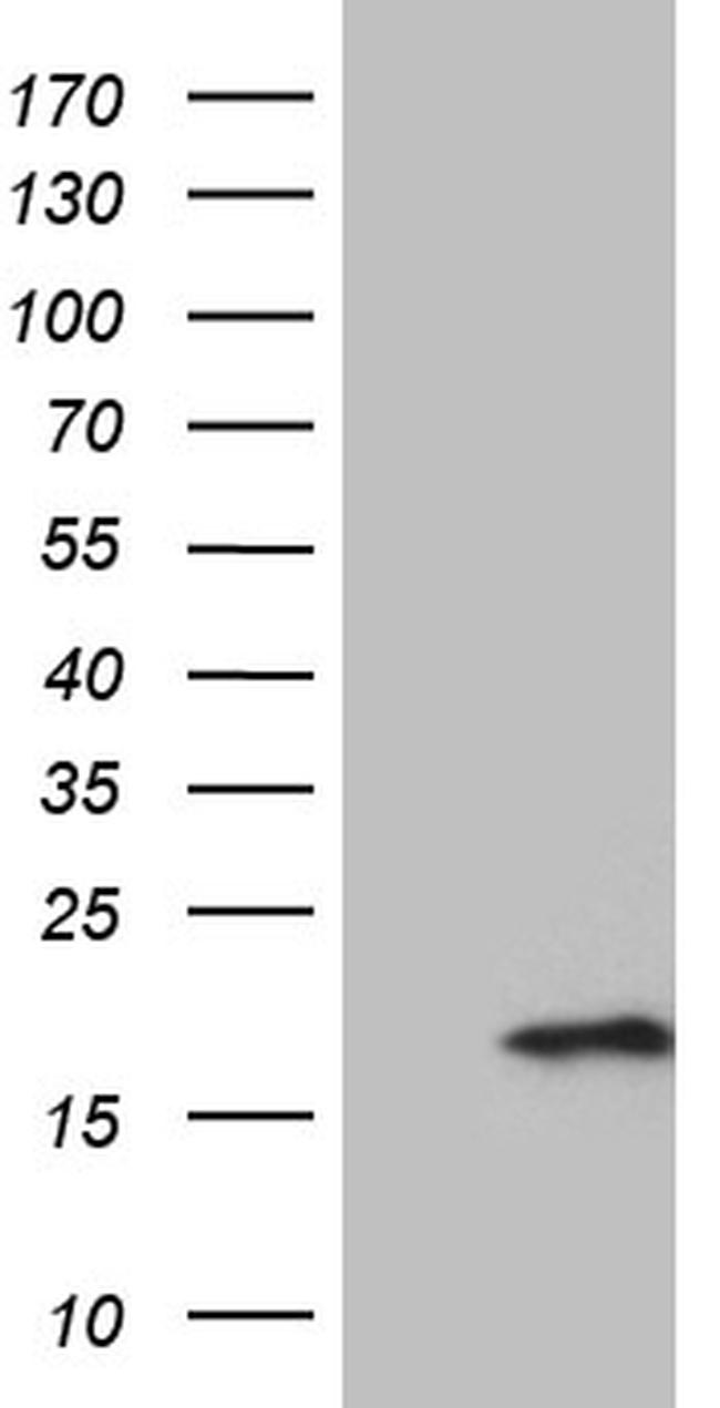 PRELID2 Antibody in Western Blot (WB)
