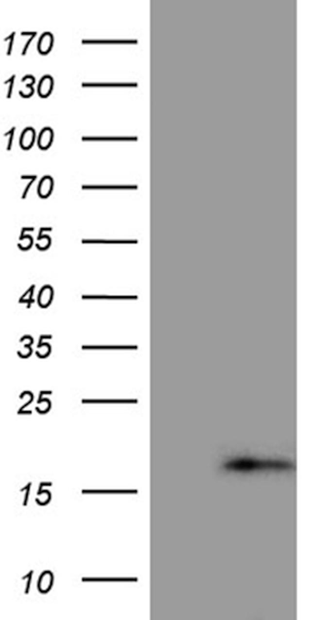 PRELID2 Antibody in Western Blot (WB)