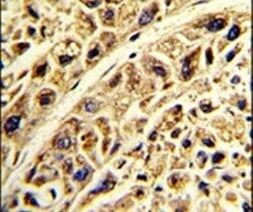 PRELP Antibody in Immunohistochemistry (IHC)