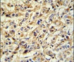 PRELP Antibody in Immunohistochemistry (IHC)