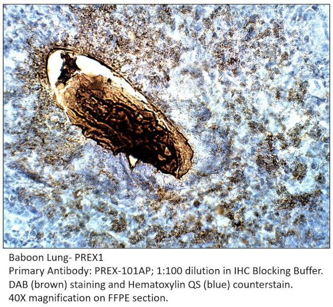 PREX1 Antibody in Immunohistochemistry (IHC)