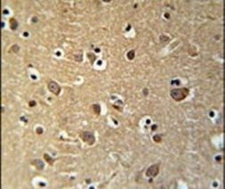 PRG2 Antibody in Immunohistochemistry (IHC)