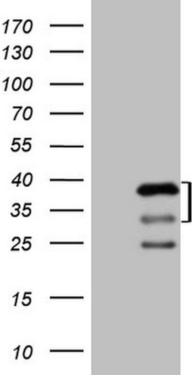 PRKAB2 Antibody in Western Blot (WB)