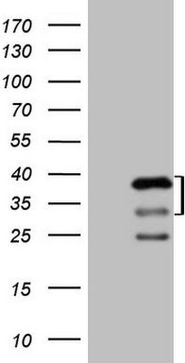 PRKAB2 Antibody in Western Blot (WB)