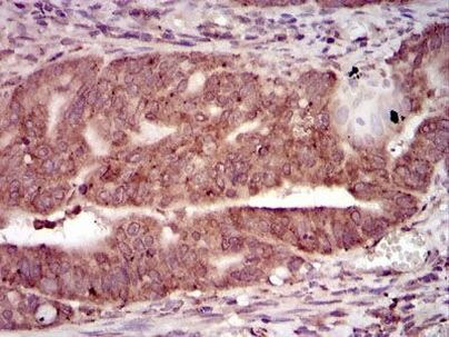 PKA gamma Antibody in Immunohistochemistry (Paraffin) (IHC (P))