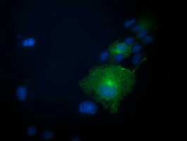 PRKAR1B Antibody in Immunocytochemistry (ICC/IF)