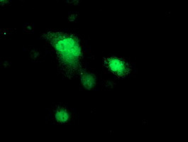 PRKAR1B Antibody in Immunocytochemistry (ICC/IF)