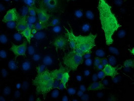 PRKAR1B Antibody in Immunocytochemistry (ICC/IF)