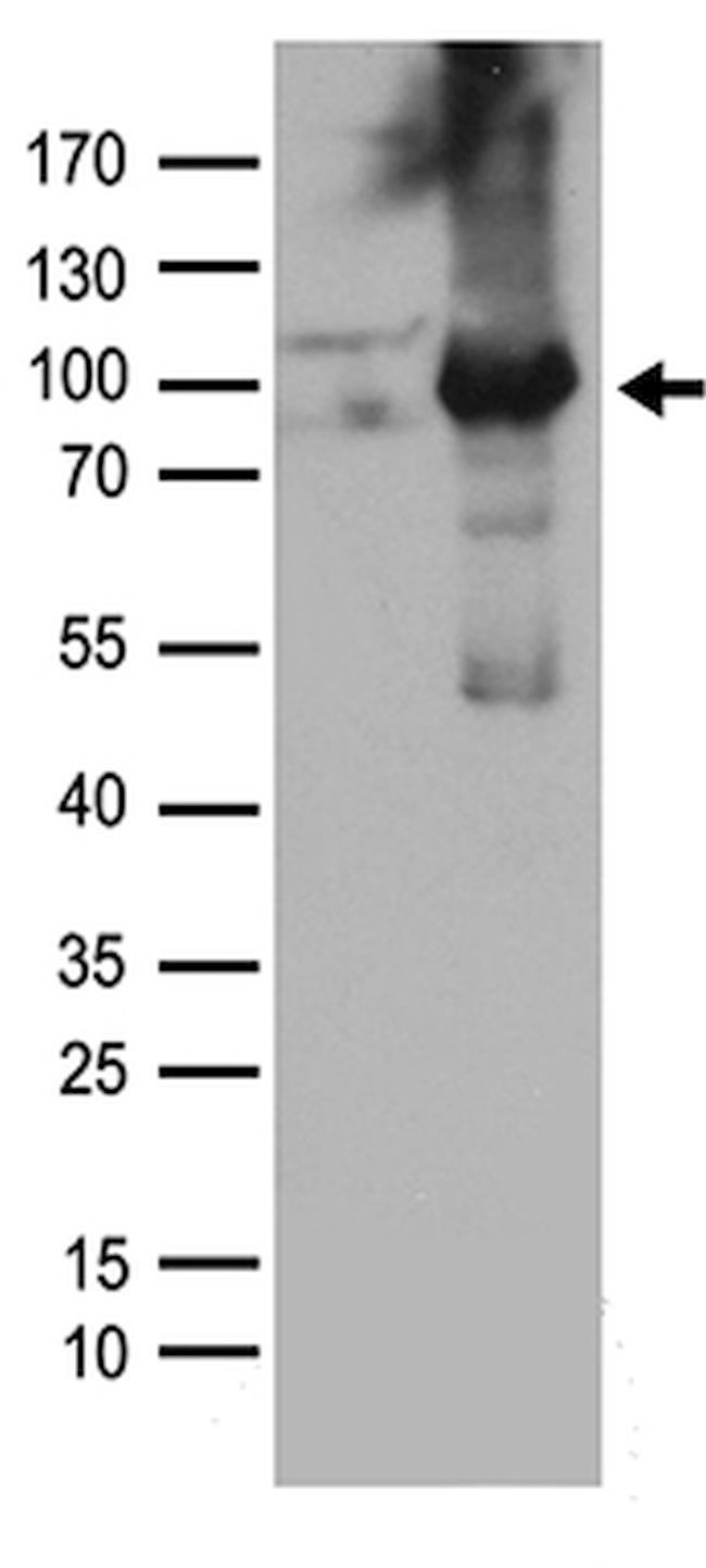 PRKCD Antibody in Western Blot (WB)