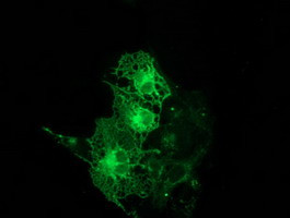 PRKCE Antibody in Immunocytochemistry (ICC/IF)