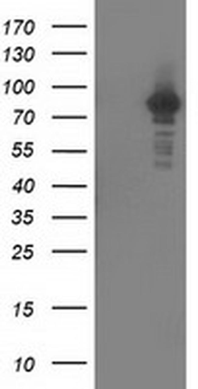 PRKCE Antibody in Western Blot (WB)
