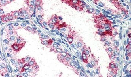 PKC zeta Antibody in Immunohistochemistry (Paraffin) (IHC (P))