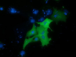 PRKD2 Antibody in Immunocytochemistry (ICC/IF)