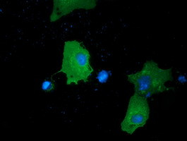 PRKD2 Antibody in Immunocytochemistry (ICC/IF)