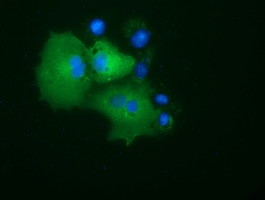 PRKD2 Antibody in Immunocytochemistry (ICC/IF)