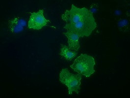 PRKD2 Antibody in Immunocytochemistry (ICC/IF)